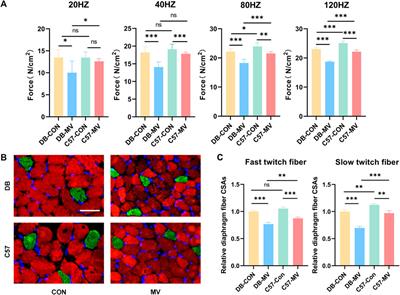 Identification of key genes affecting ventilator-induced diaphragmatic dysfunction in diabetic mice